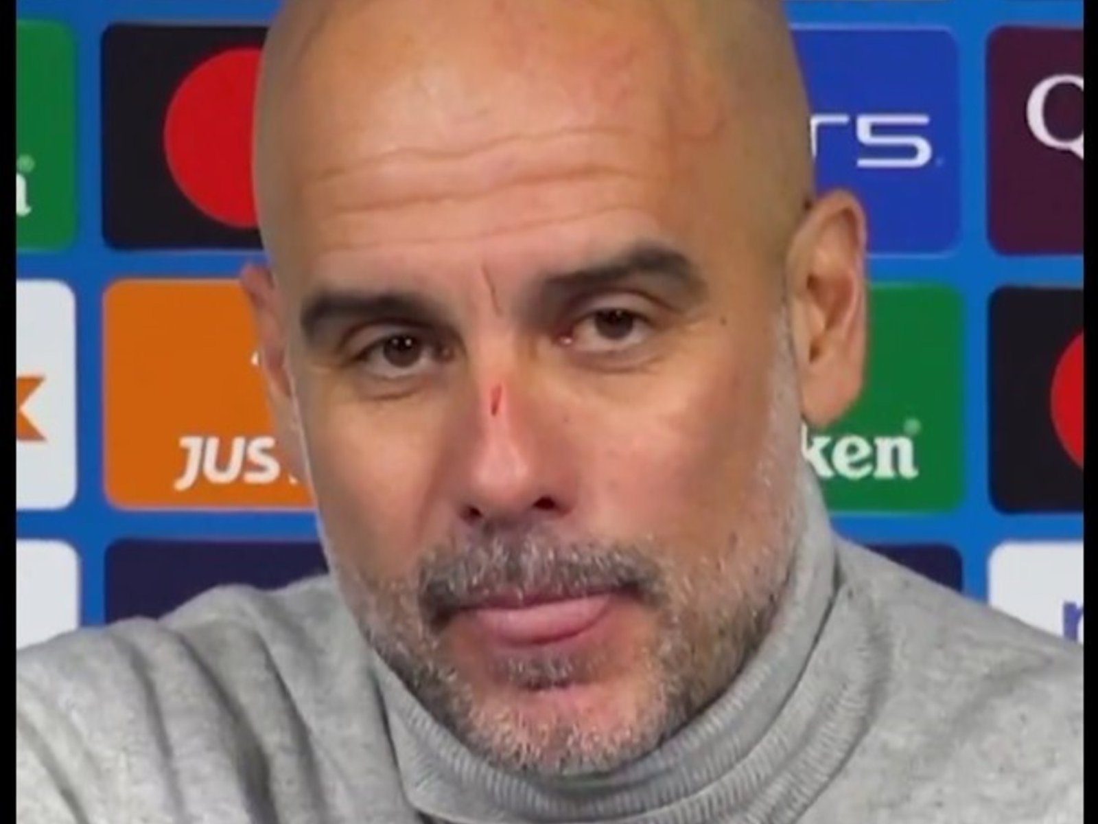 Pep Guardiola apareció lleno de arañazos en plena crisis del Manchester City y dio una extraña explicación: “Quise hacerme daño”