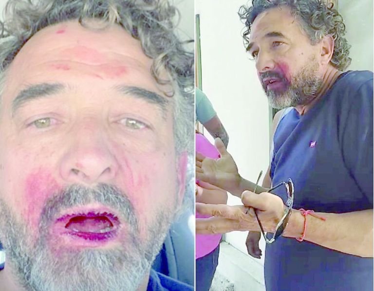 Procesarán a dos funcionarios por el violento ataque al ex intendente Albaini