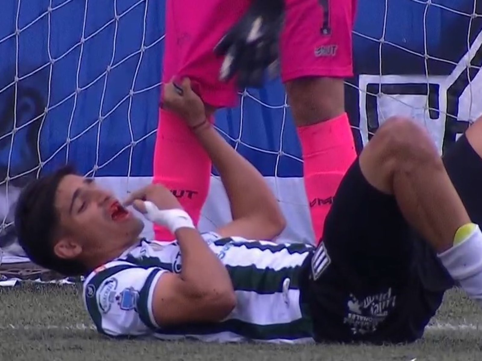 un jugador se fue en ambulancia después de que le sacaran los dientes de una trompada