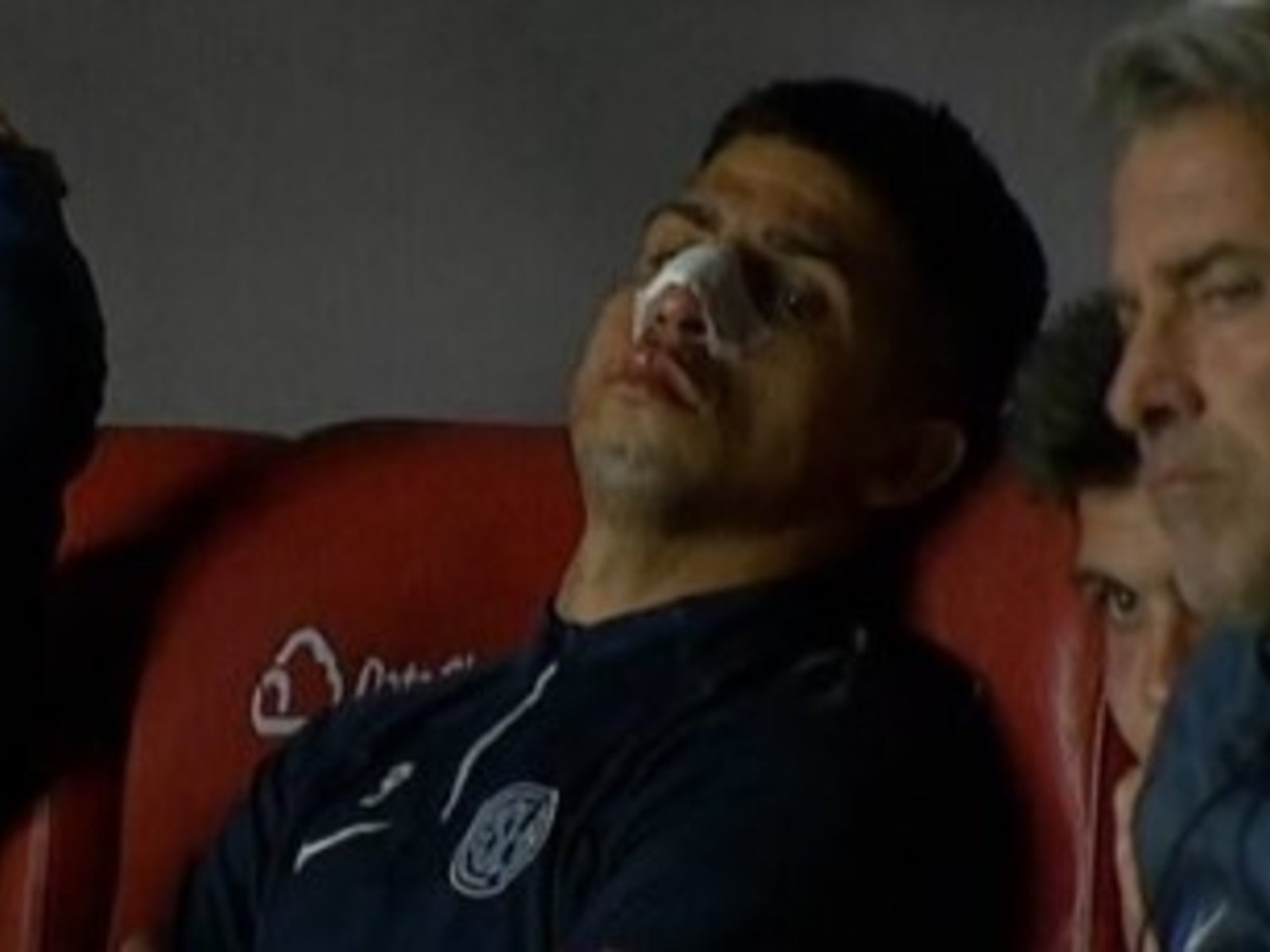 Alexis Cuello chocó de cabeza contra los carteles y salió con la nariz rota de la cancha de Argentinos