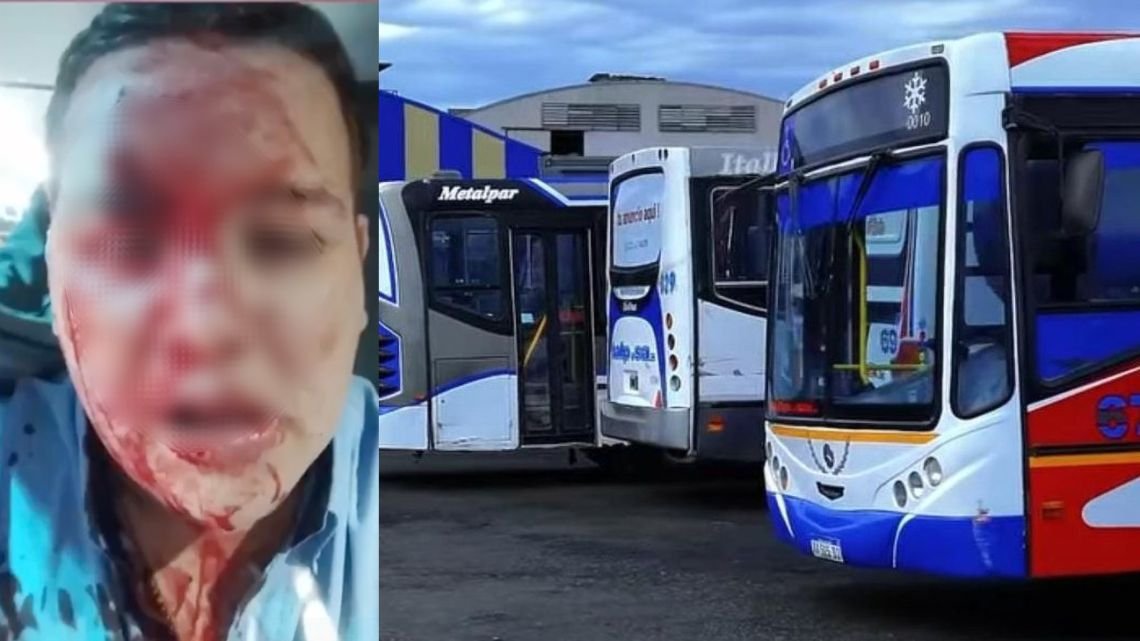 La Matanza: le dieron un botellazo en la cara a un colectivero y hay dos líneas de paro