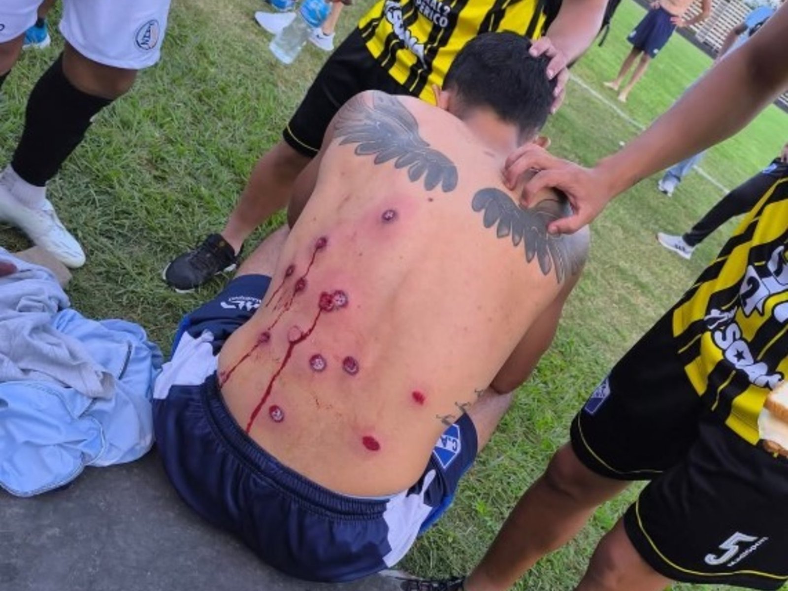 hubo heridos por balas de goma y una persona fue hospitalizada