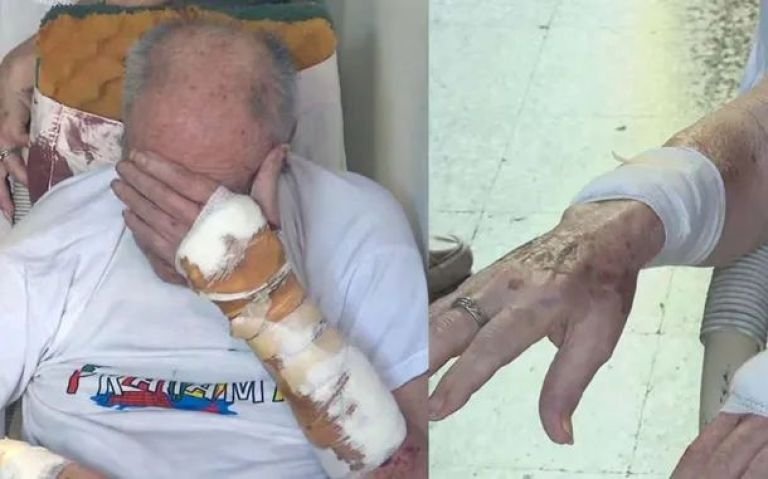 Delincuentes torturaron brutalmente a un jubilado: “Dame dólares o te doy corriente”