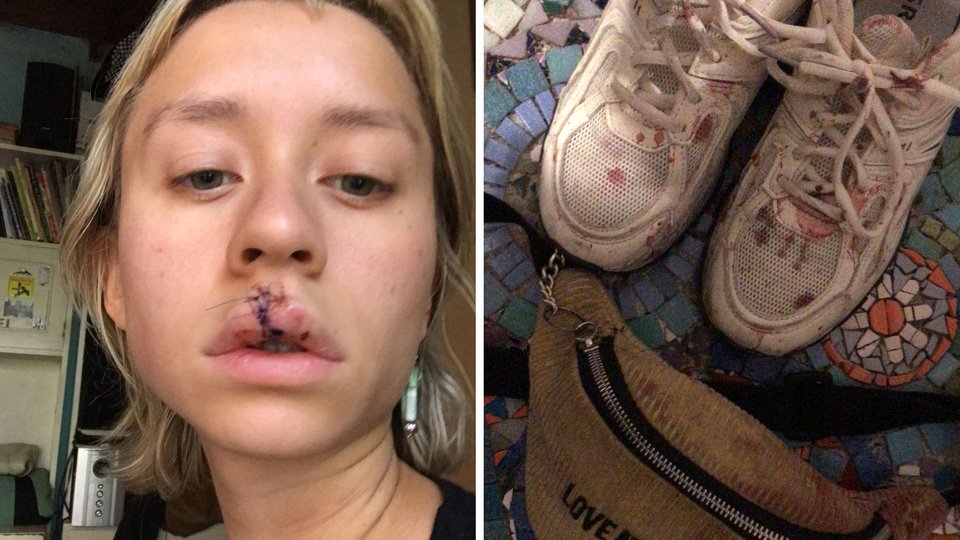 “Apoyo a los jubilados y volveré a marchar por ellos” | Ana Martínez fue a Congreso y un gendarme le disparó a la cara