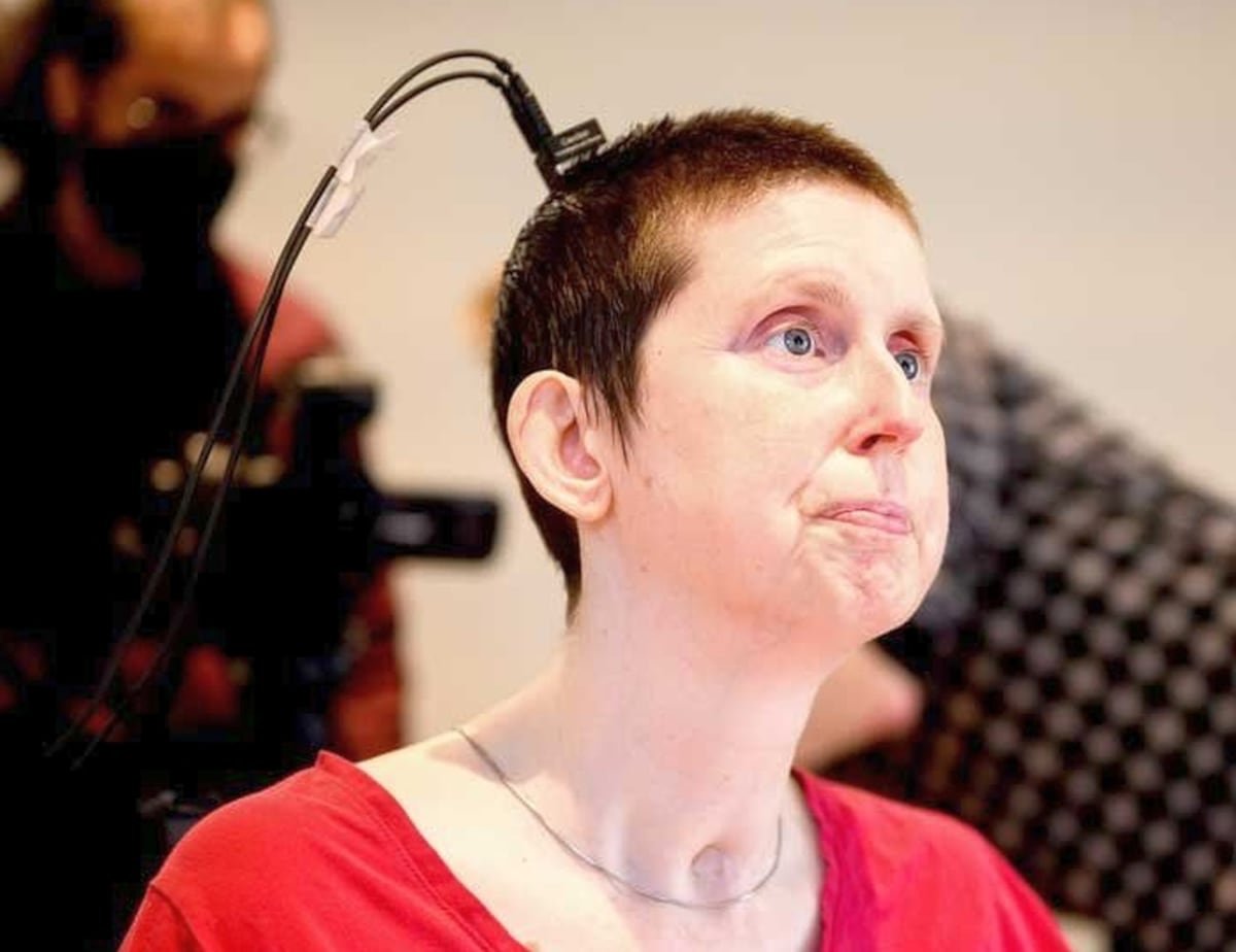 Una mujer consigue ‘hablar’ en tiempo real, tras 20 años de silencio, al conectar su cerebro a una máquina | Ciencia