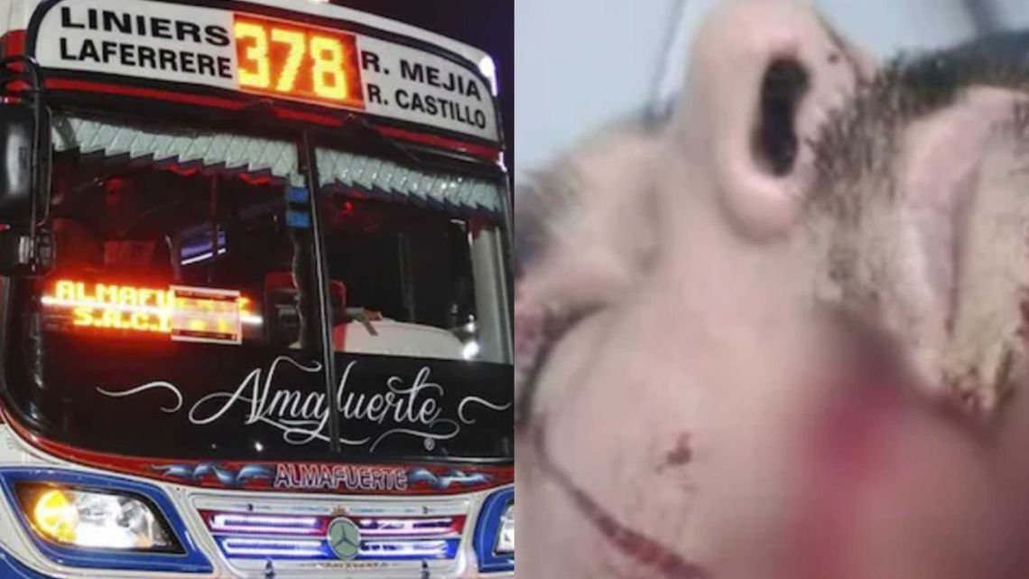 La Matanza: desfiguraron con un cuchillo a un colectivero para robarle y varias líneas suspendieron el servicio