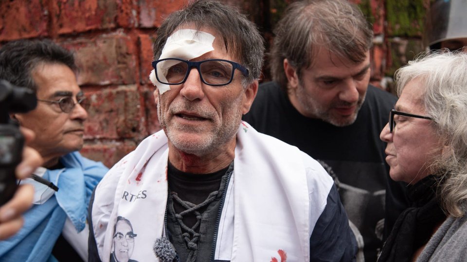 “Como decía Francisco, piden justicia social y les dan gas pimienta” | “Paco” Olveira, víctima de la represión en la marcha de jubilados