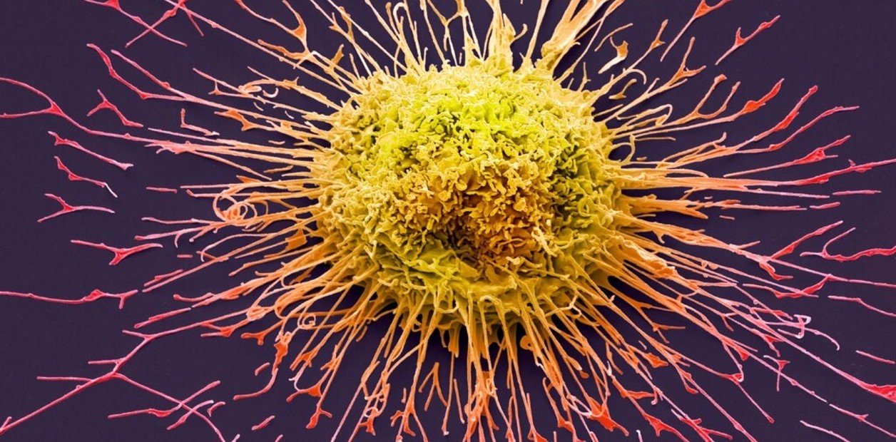 La sorprendente creencia de los argentinos sobre la cura del cáncer y por qué aún no se la conoce