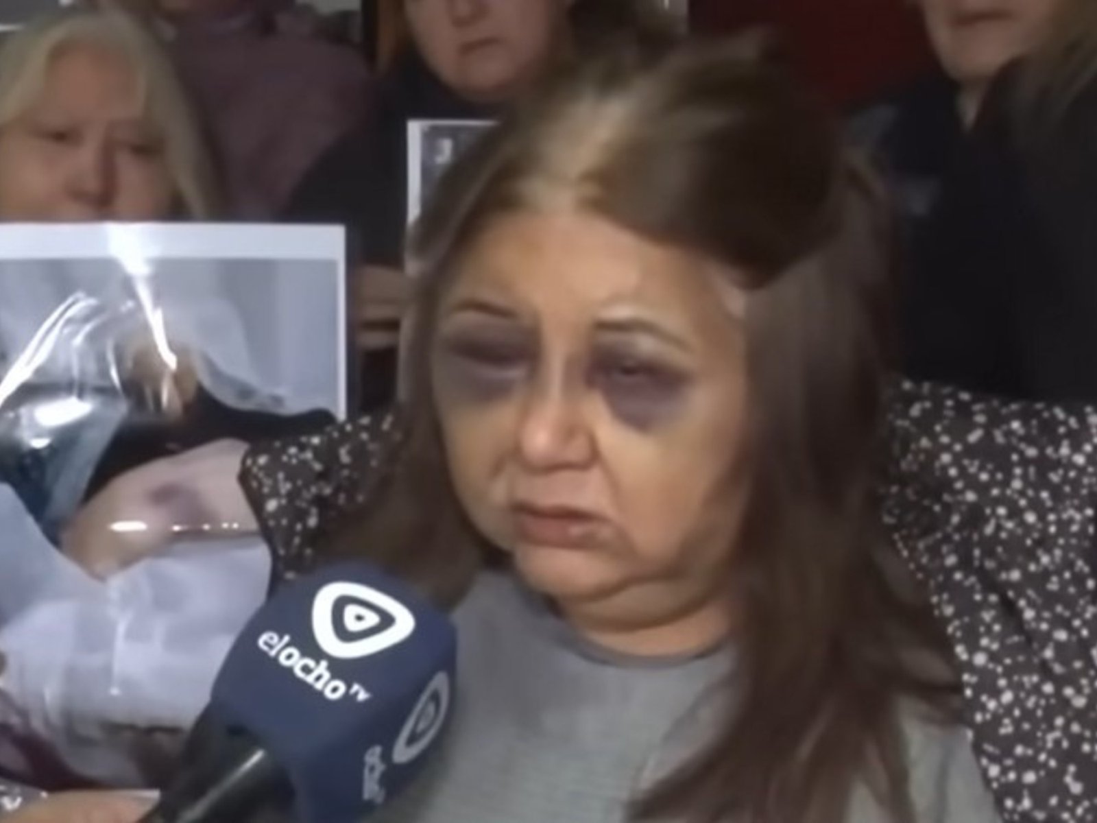 Con los ojos morados y los dedos vendados, habló la esposa del hombre que mató a su suegra a bastonazos: “Socorro, vecinos”