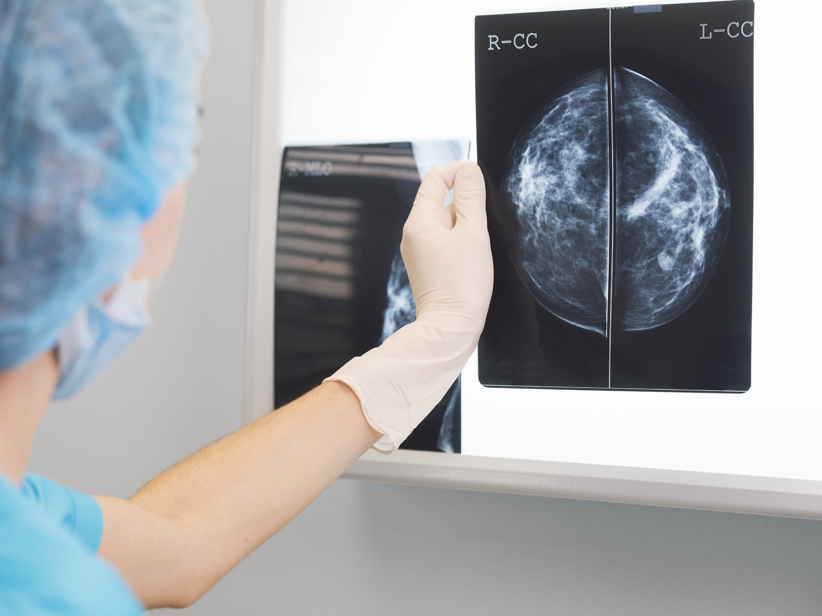 Cuánto cuestan y cómo se usan los tests genéticos que permiten detectar el riesgo de tener cáncer