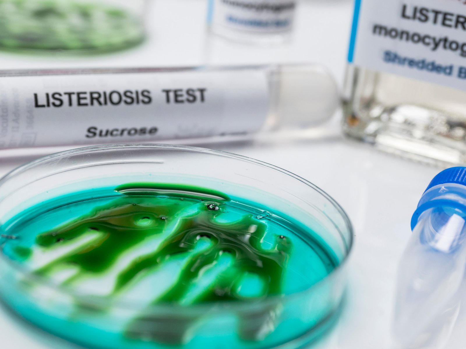 Confirman por primera vez un brote de infecciones potencialmente mortales por el consumo de un queso