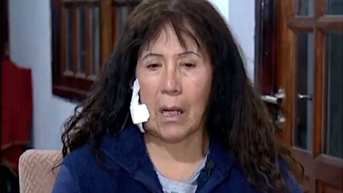 El dramático relato de la turista atacada con un ladrillazo camino a Ezeiza