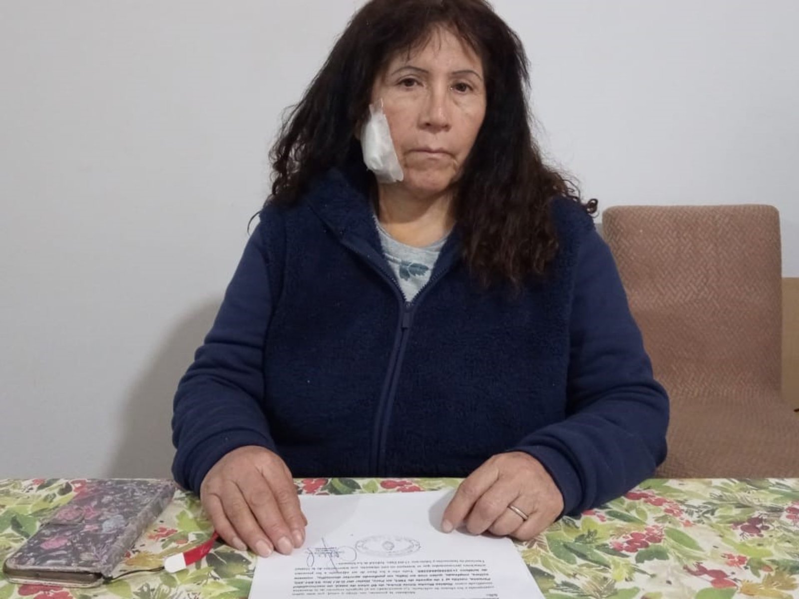 el terrible relato de la turista atacada con un ladrillazo camino a Ezeiza