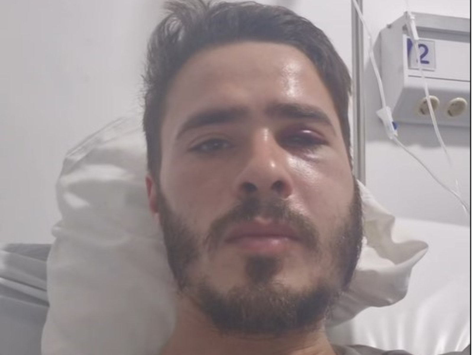 Denuncian al hijo de un concejal kirchnerista por desmayar de una trompada a un hombre que confundió con un militante libertario