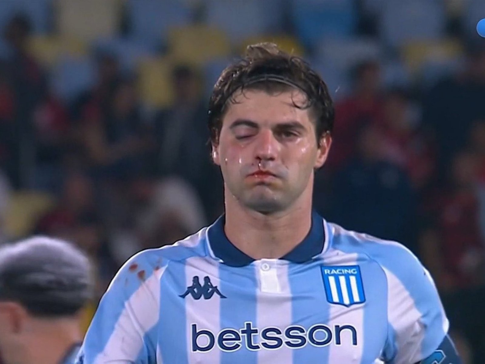 Santiago Sosa quedó con el ojo como un boxeador por un codazo de Marcos Rojo en la semifinal de la Libertadores de Flamengo vs Racing