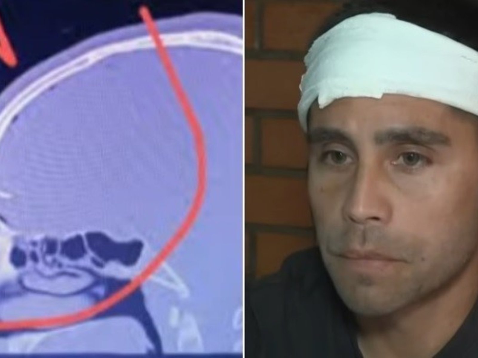 “No sabían si podían salvarme, por suerte lo puedo contar”