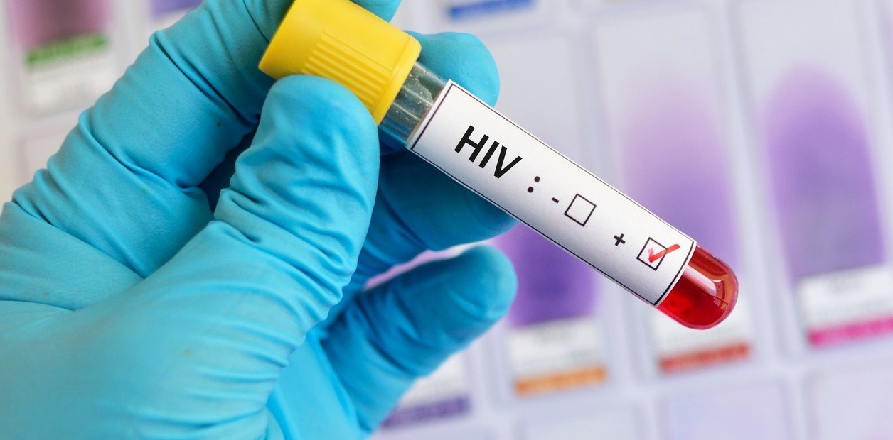 Prueban en el país un método inédito para reducir mucho la chance de contraer el virus del Sida: cómo participar