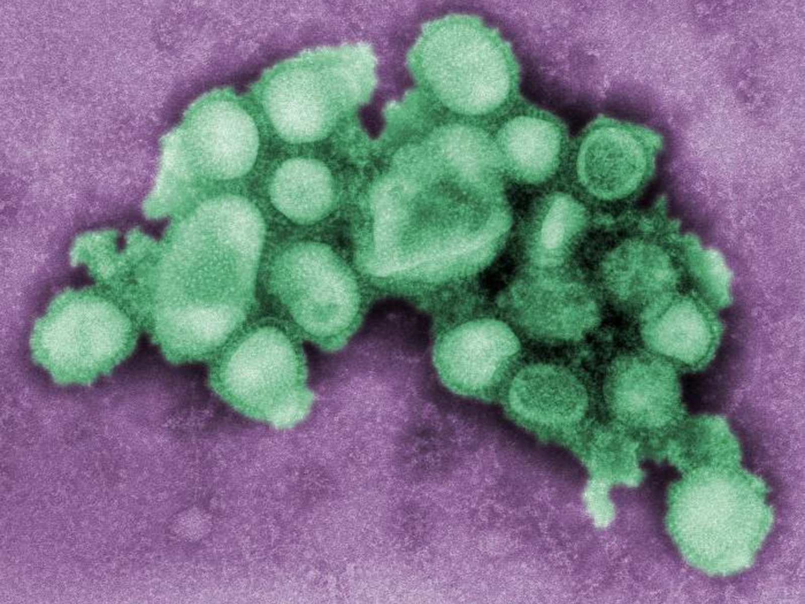 Avanza la súper gripe H3N2, ya está más cerca de Argentina y recomiendan aplicarse la vacuna