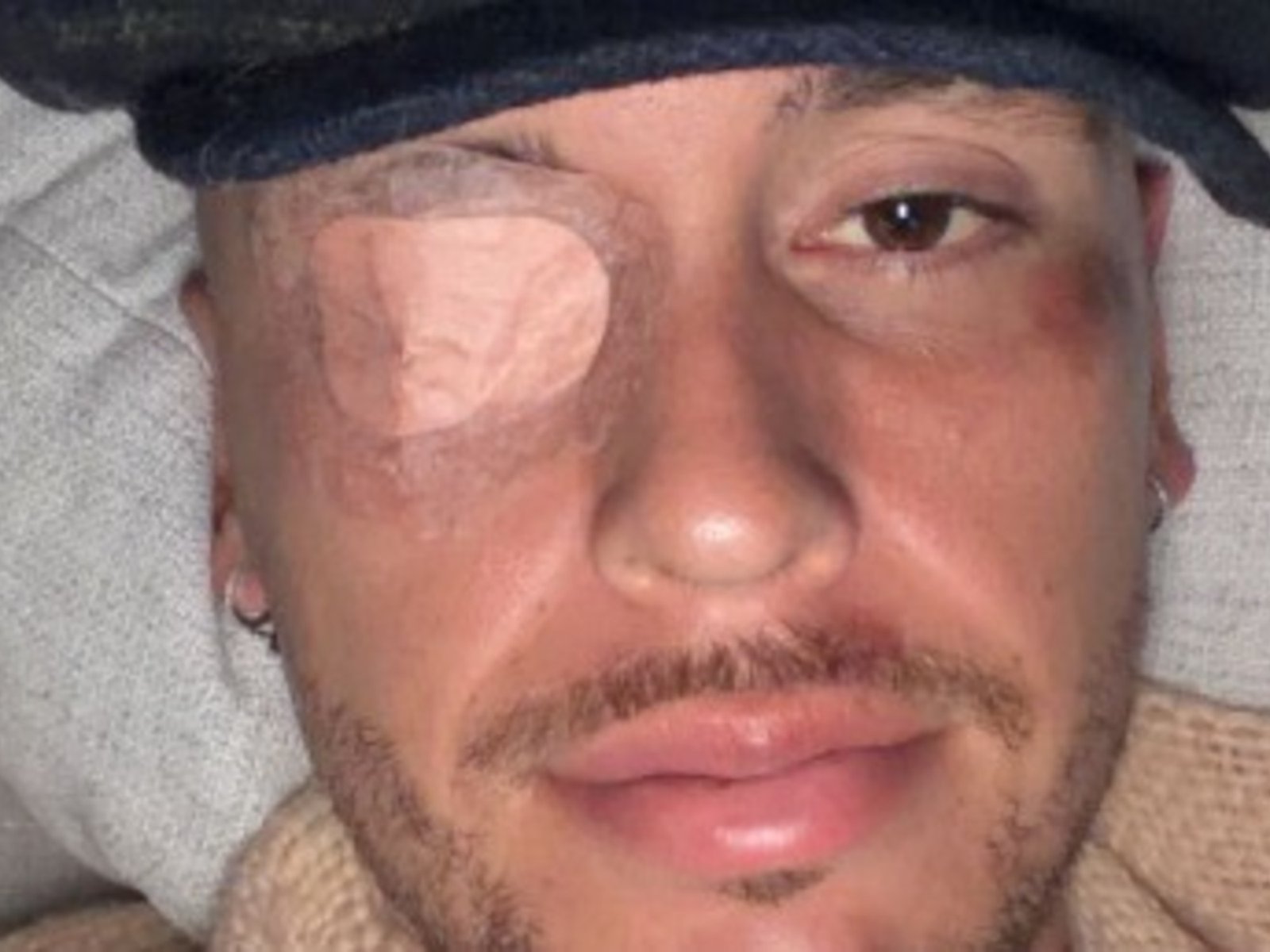 tras fracturarse, sufrió una parálisis facial y se pierde la pretemporada en México