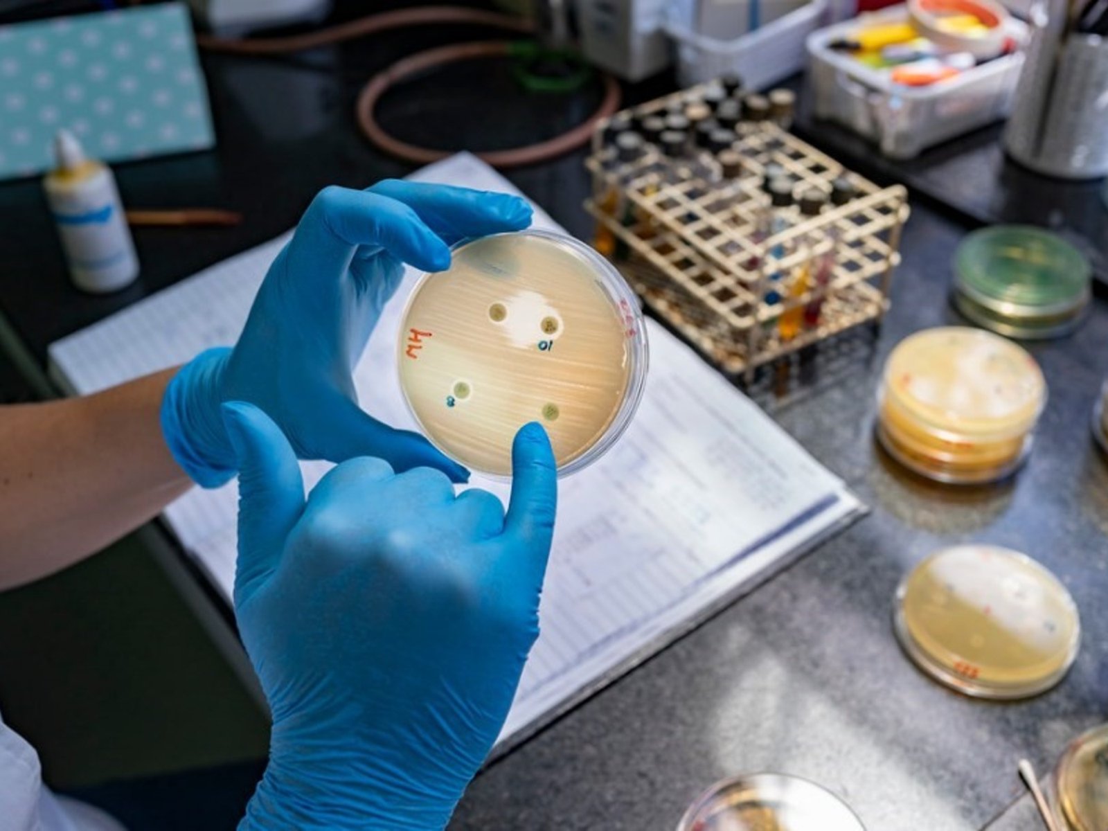 Detectaron la “supergripe” H3N2 en ocho provincias de Argentina y el 30% de los casos derivó en internación