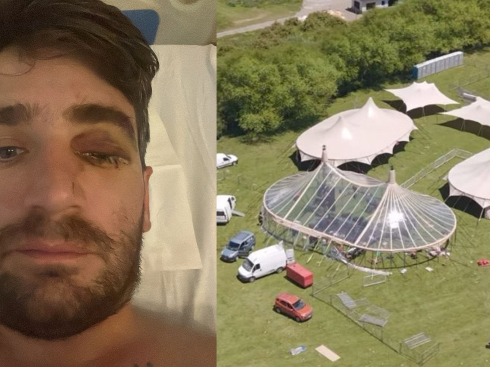 Fue a celebrar Año Nuevo a la Patagonia y perdió un ojo por un petardo en una fiesta privada