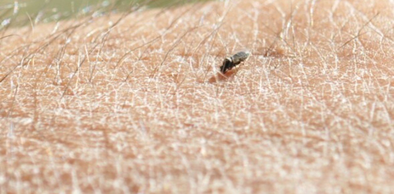 qué es el barigüí y cómo combatirlo