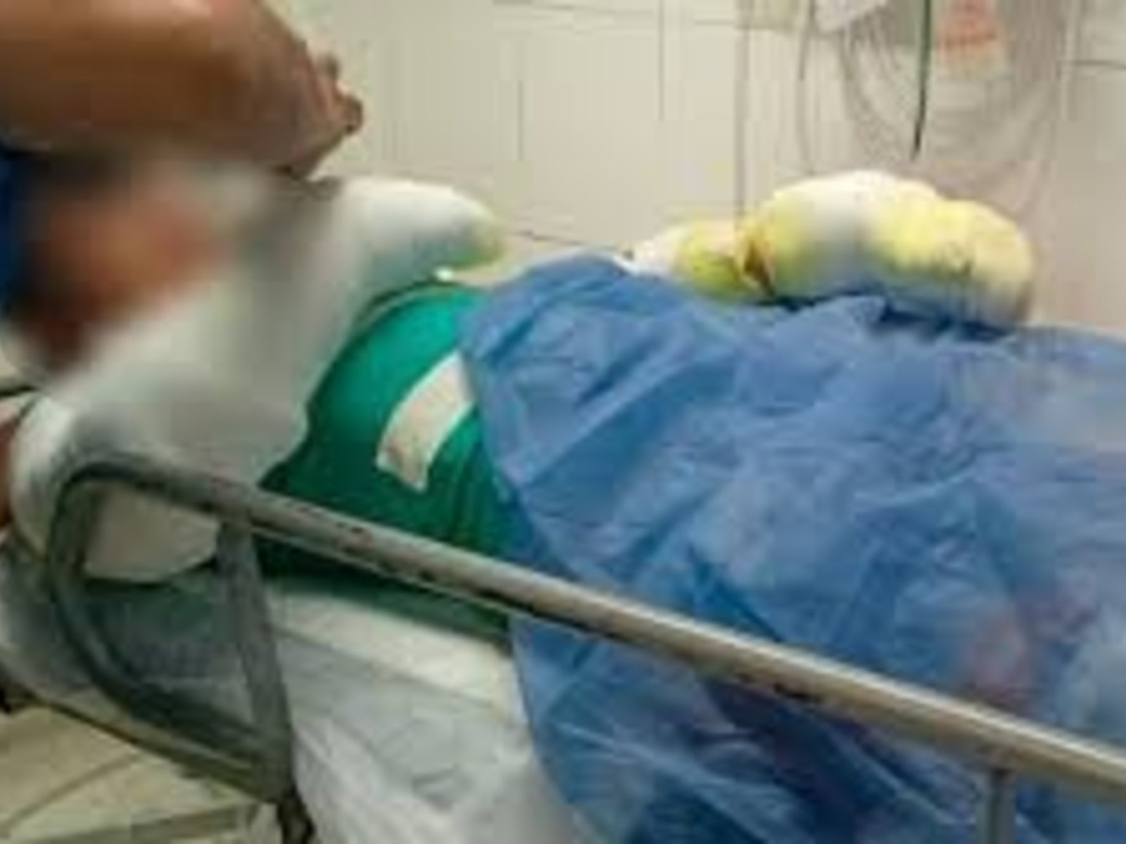 un adolescente está con el 60% del cuerpo quemado después de que le explotó su celular