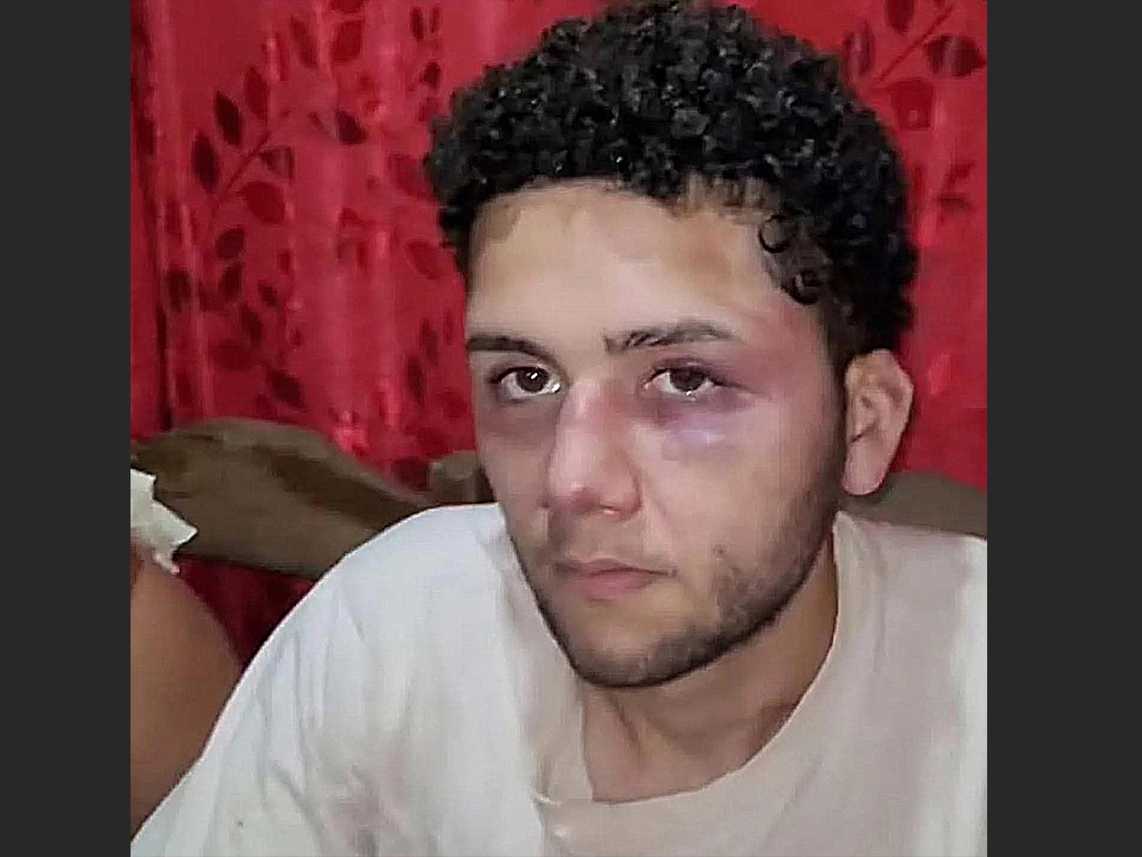 sus empleadores lo atacaron brutalmente para no pagarle