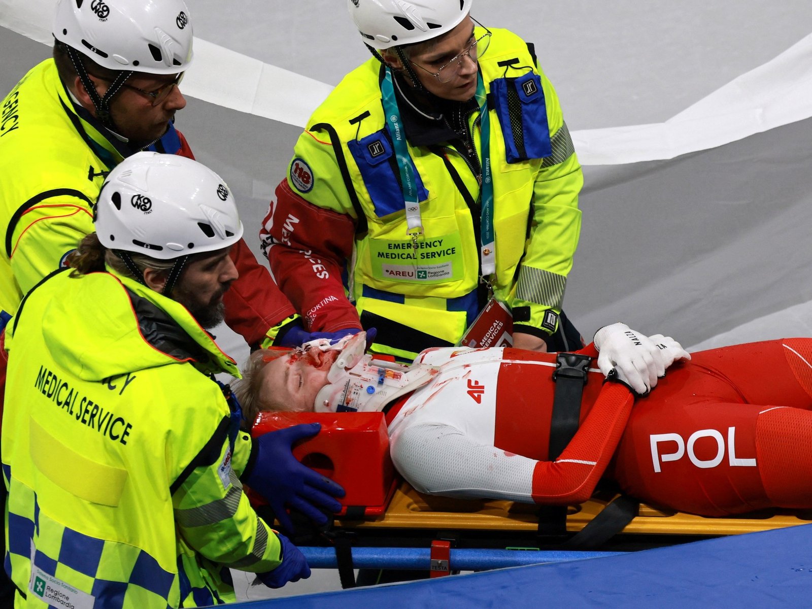 una patinadora sufrió un profundo corte a milímetros del ojo