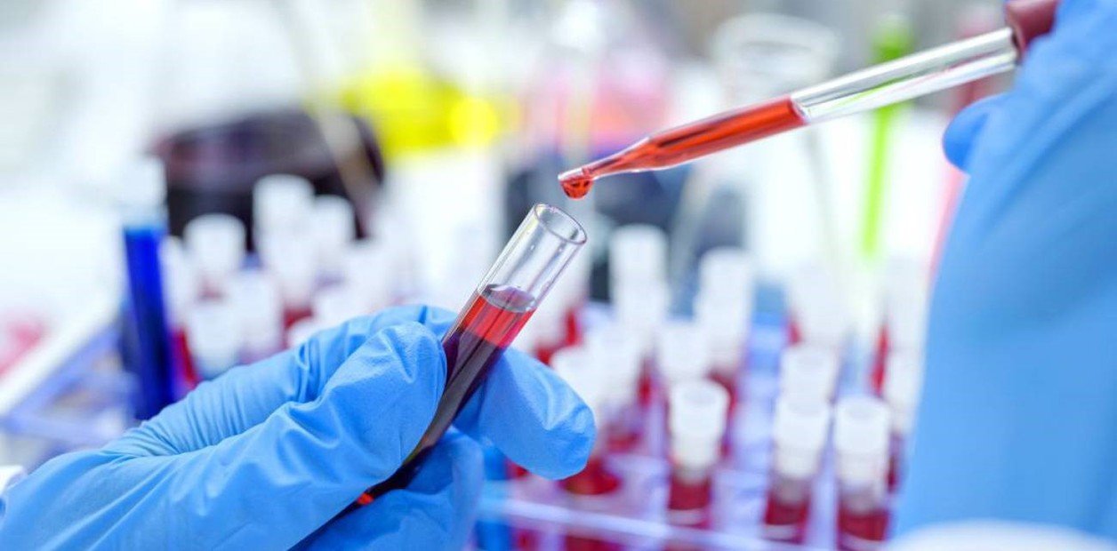 "El paciente de Oslo": logran una nueva curación del VIH con un trasplante de células madre y por primera vez el donante fue un hermano