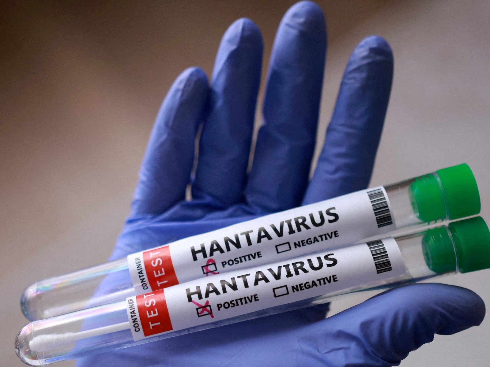 Confirman que una droga usada para otra enfermedad sirve contra el hantavirus y ahora se abre una esperanza