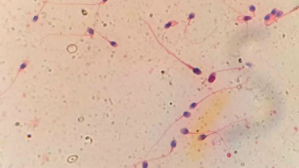 HyperSperm, la innovación argentina que mejora la fertilización in vitro y abre una nueva esperanza para miles de parejas