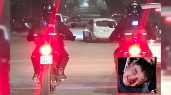 Intentó robar una moto y lo lincharon: terminó internado