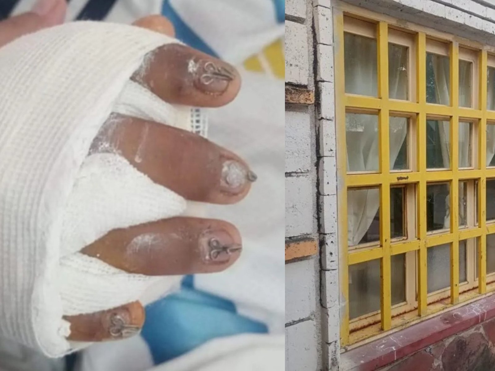 una ventana cayó sobre un niño y la familia denunció que las instalaciones escolares estaban en mal estado