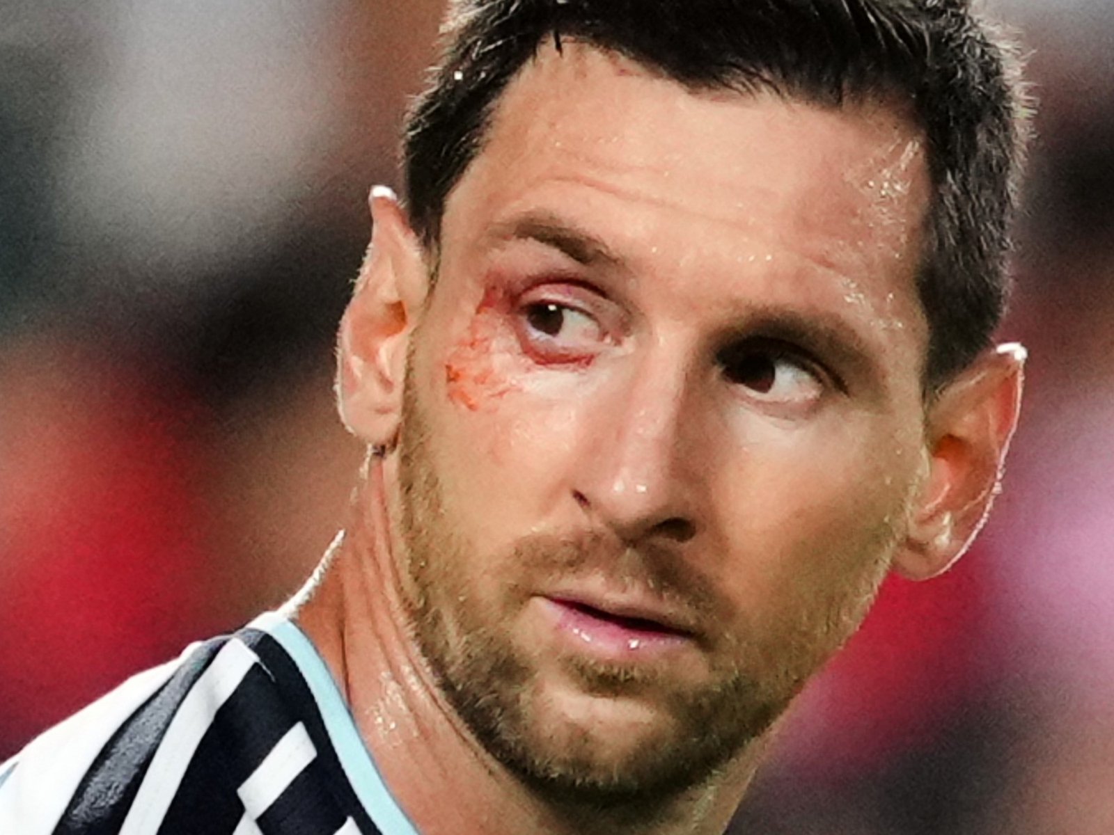 el 10 recibió atención en medio de Argentina vs Suiza