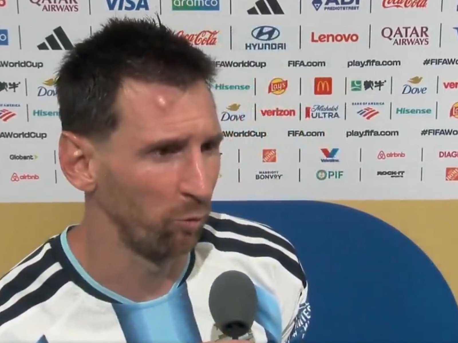 el capitán argentino lució un golpe en su frente tras impactar con la rodilla de un rival