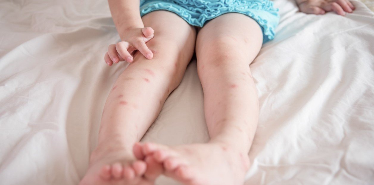 Advierten por un hábito que sube el riesgo de que los niños desarrollen las alergias que potenció la pandemia