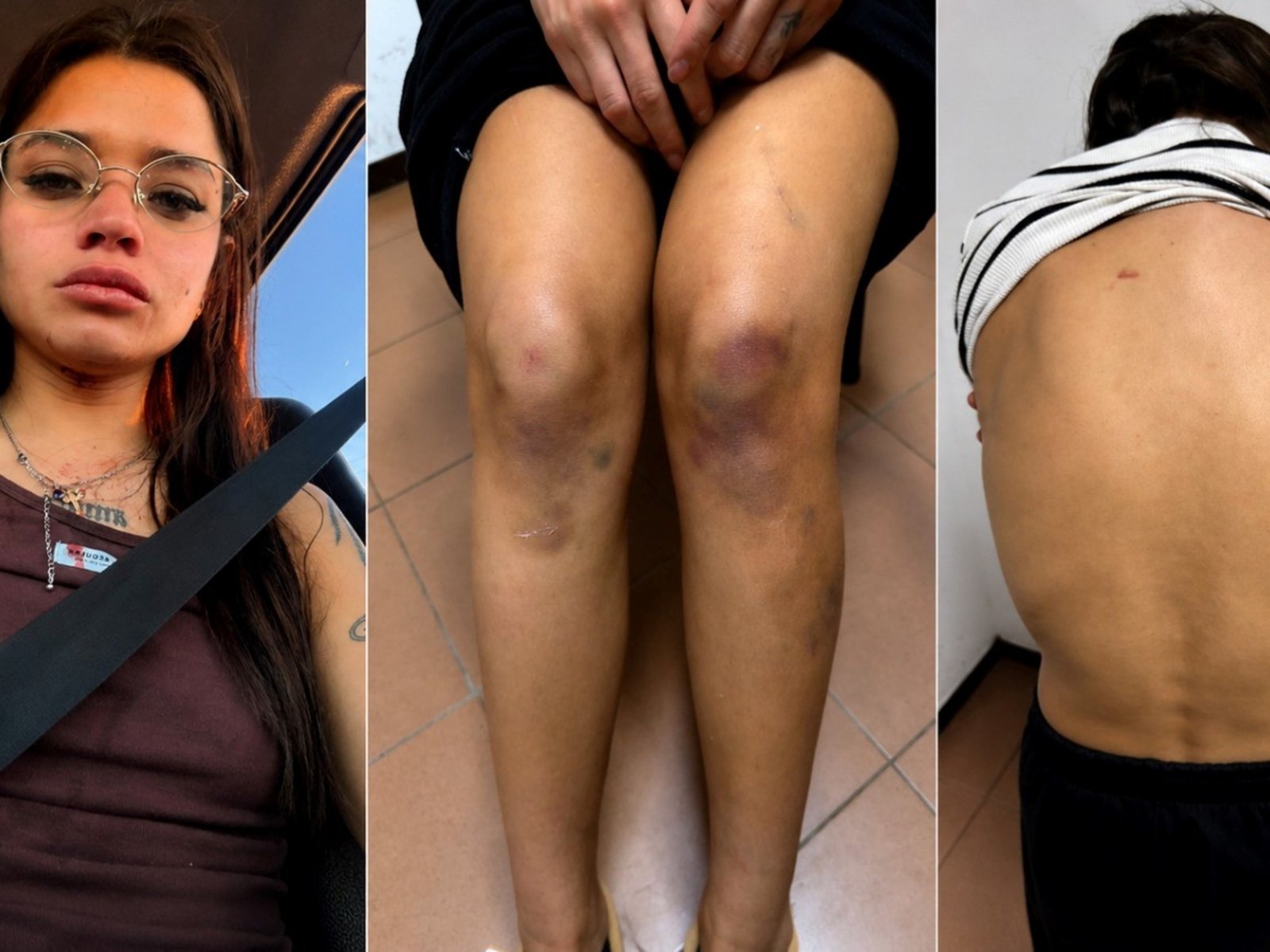 Qué dice el informe sobre las lesiones de Victoria Cantero, la joven detenida por matar a su novio en Chaco