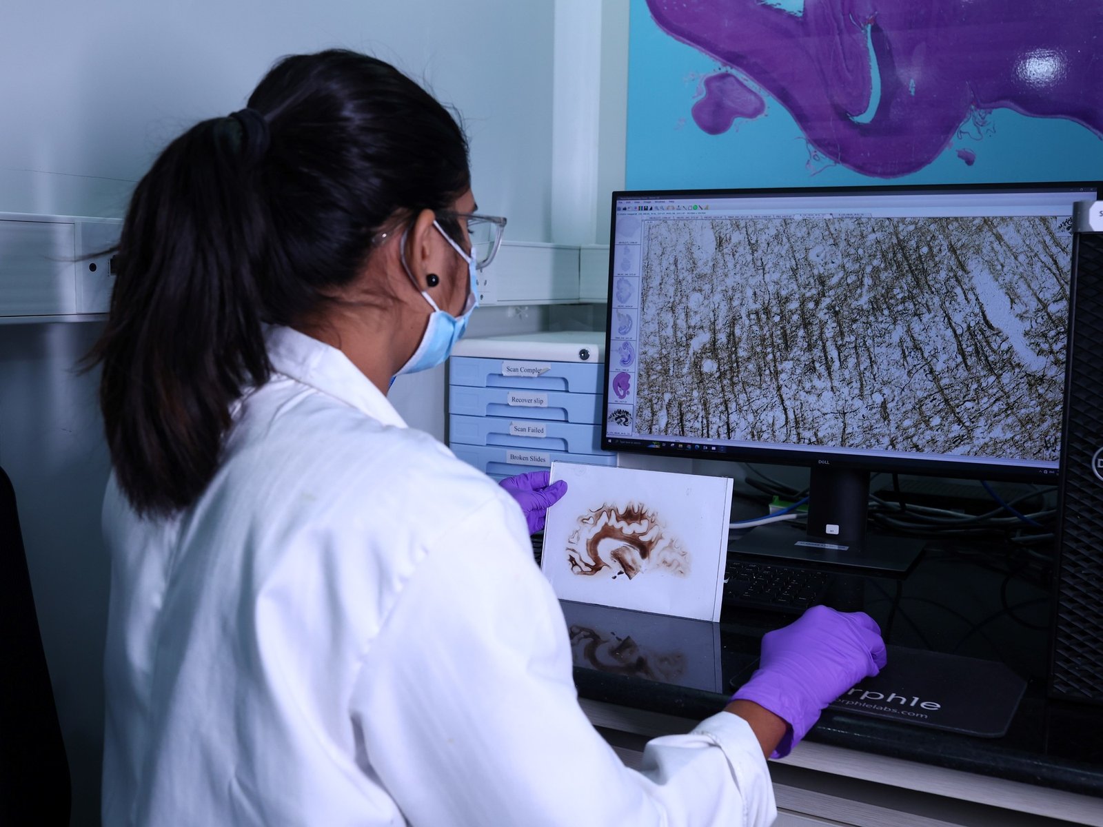 así se construye el atlas celular que busca descifrar las enfermedades neurodegenerativas